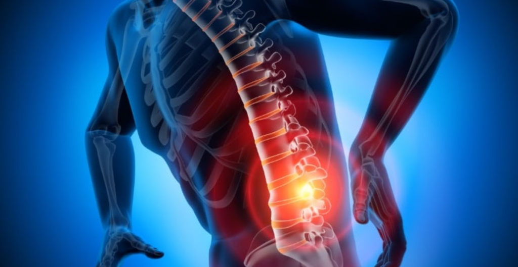 How Long Does It Take for a Chiropractor to Fix a Bulging Disc?