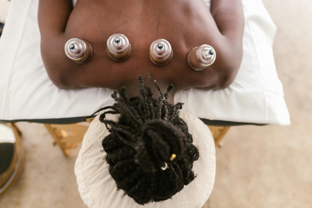 cupping