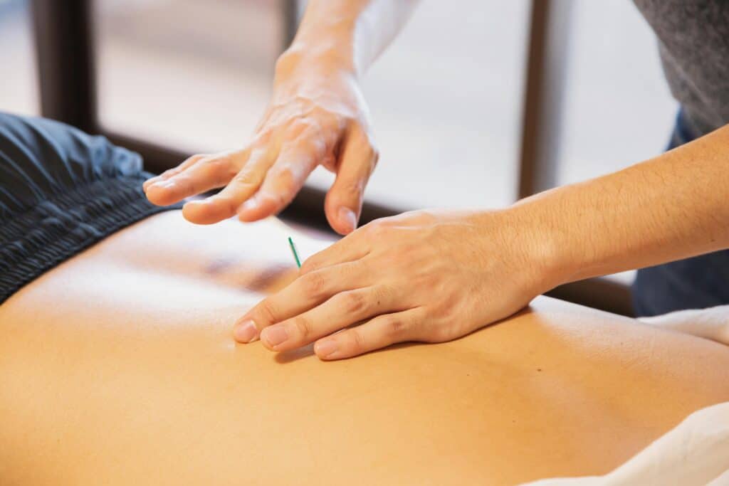 needling method 