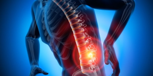 How Long Does It Take for a Chiropractor to Fix a Bulging Disc?