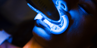 Laser Treatment for Gum Disease: Pros and Cons