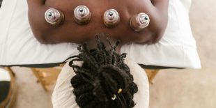 cupping